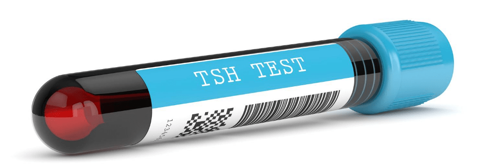 TSH Tests For Thyroid